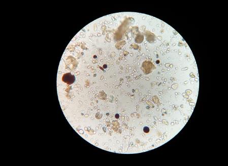 ?土壤中有哪些微生物？土壤微生物在生態系統中的作用